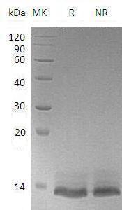 Human OSTN (His tag) recombinant protein