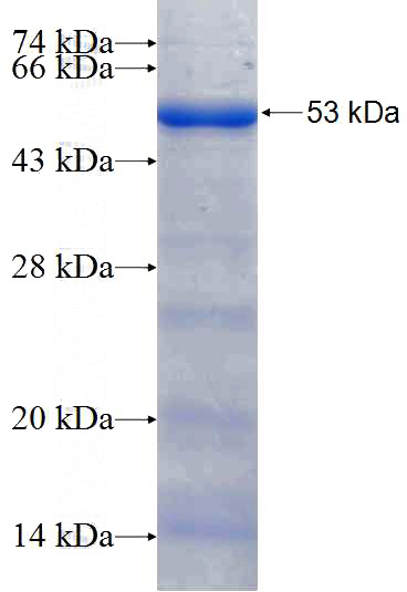 Recombinant Human RPUSD2 SDS-PAGE