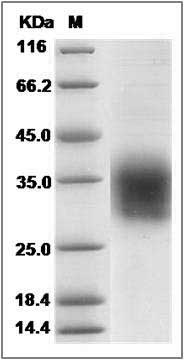 Rat CLEC4A2 / DCIR Protein (His Tag) SDS-PAGE