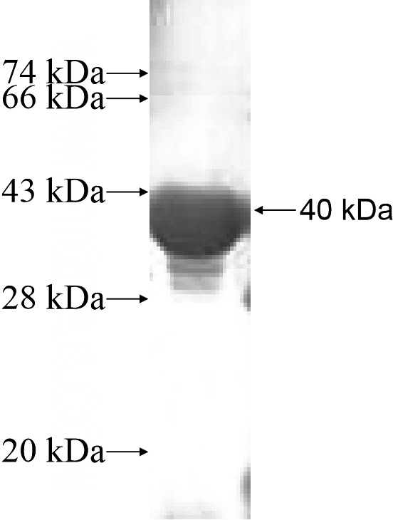 Recombinant Human MYL9 SDS-PAGE
