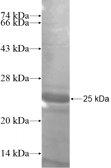 Recombinant Human PHLPP SDS-PAGE