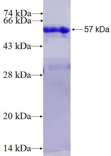 Recombinant Human RPUSD4 SDS-PAGE