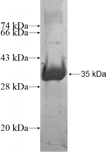 Recombinant Human ZNF511 SDS-PAGE