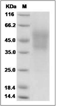 Mouse M-CSF / CSF-1 Protein (His Tag) SDS-PAGE