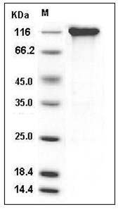 Rat gp130 / IL6ST / CD130 Protein (His & Fc Tag) SDS-PAGE