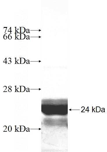 Recombinant Human RPP21 SDS-PAGE