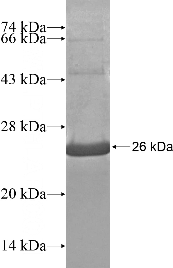 Recombinant Human TMPRSS11A SDS-PAGE