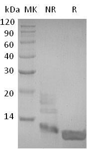 Human DEFB104A/DEFB104/DEFB4;/DEFB104B recombinant protein