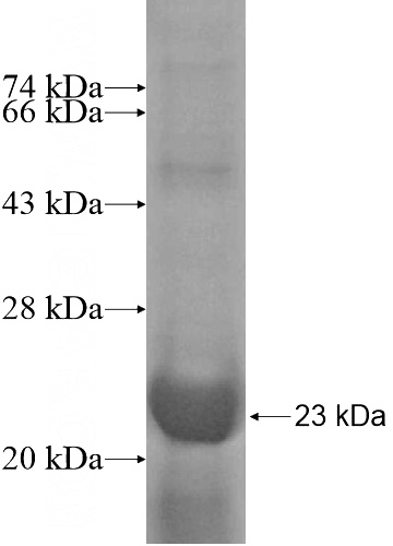 Recombinant Human FGD3 SDS-PAGE