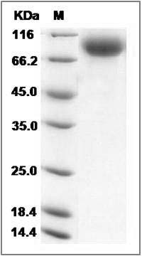 Mouse E-Selectin / CD62e / SELE Protein (His Tag) SDS-PAGE