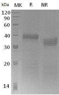 Mouse Igfbp5/Igfbp-5 (His tag) recombinant protein
