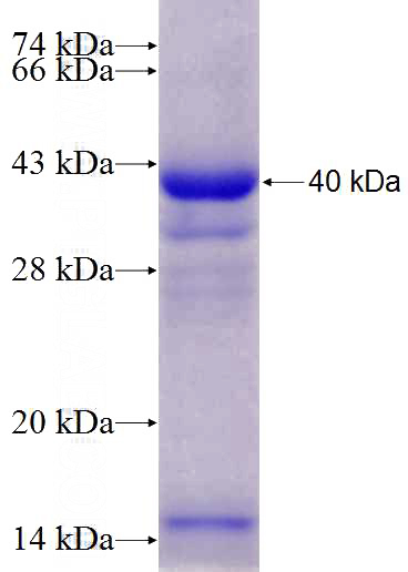 Recombinant Human CYP1A1 SDS-PAGE