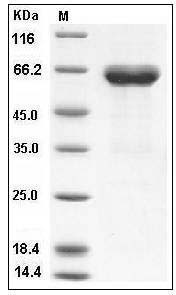 Human Ephrin-B1 / EFNB1 Protein (His & Fc Tag) SDS-PAGE