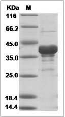Ebola virus EBOV (subtype Sudan, strain Gulu) VP40 / Matrix protein VP40 Protein (His Tag)