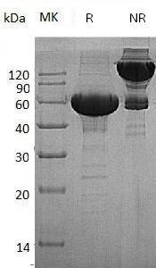Human MMP3/STMY1 (His tag) recombinant protein