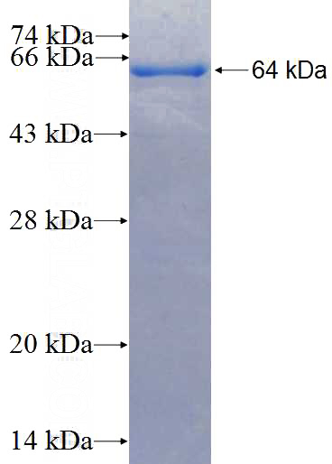 Recombinant Human GTPBP2 SDS-PAGE