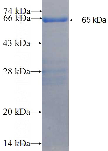 Recombinant Human NRIP1 SDS-PAGE
