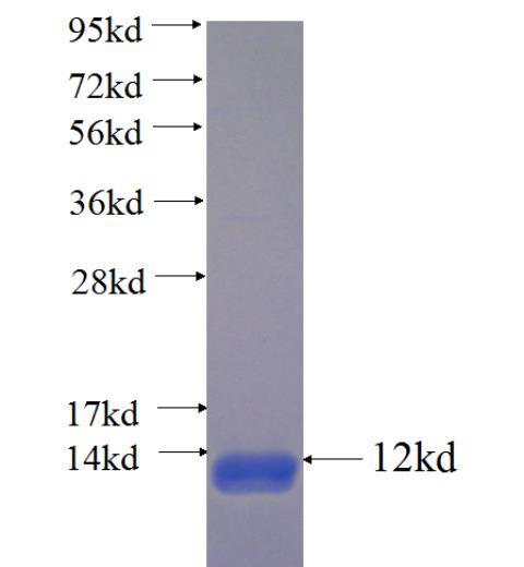 Recombinant human ATP2B4 SDS-PAGE