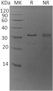 Human ZMYND19/MIZIP (His tag) recombinant protein