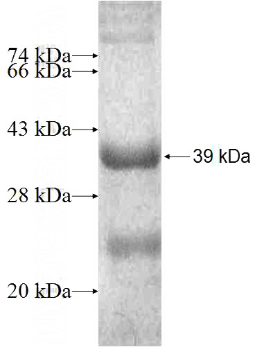 Recombinant Human SURF1 SDS-PAGE