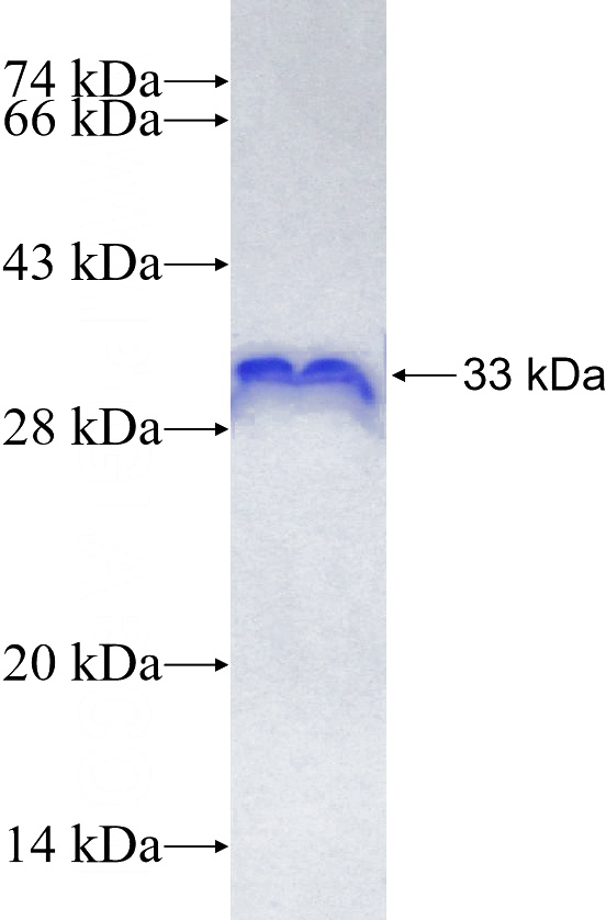 Recombinant Human SDC4 SDS-PAGE