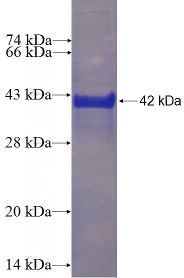 Recombinant Human IFT20 SDS-PAGE
