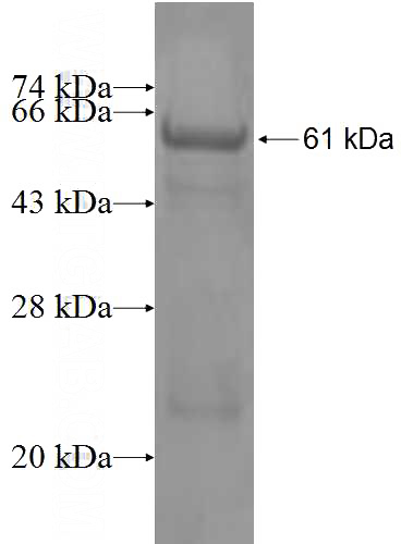 Recombinant Human USP24 SDS-PAGE