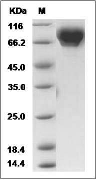 Human VASN / Vasorin Protein (His Tag) SDS-PAGE