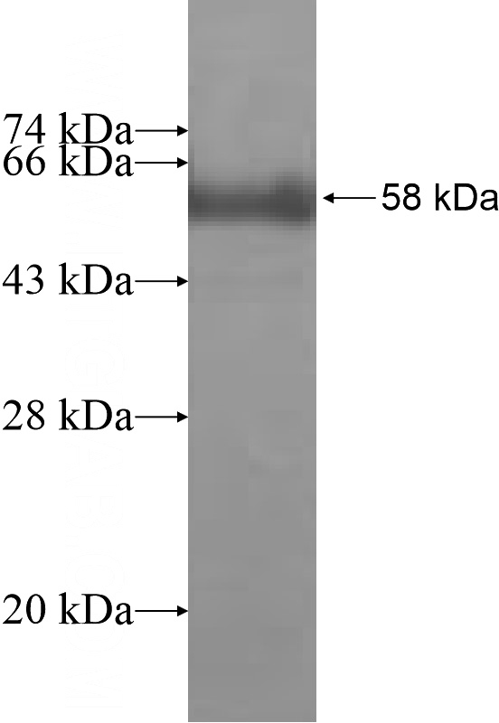 Recombinant Human APLP2 SDS-PAGE