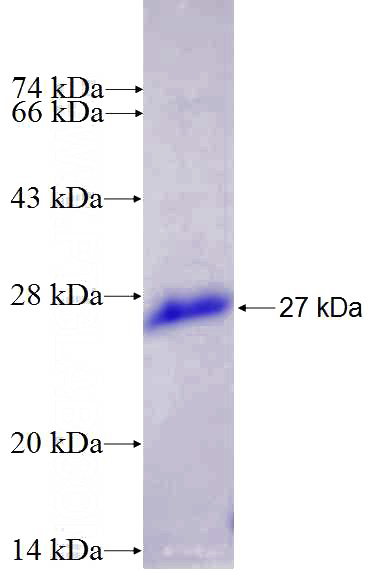 Recombinant Human JOSD1 SDS-PAGE