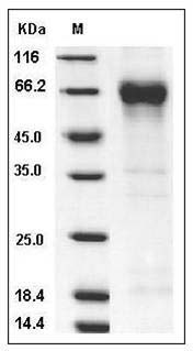 Human ANG2 / Angiopoietin-2 Protein (His Tag) SDS-PAGE