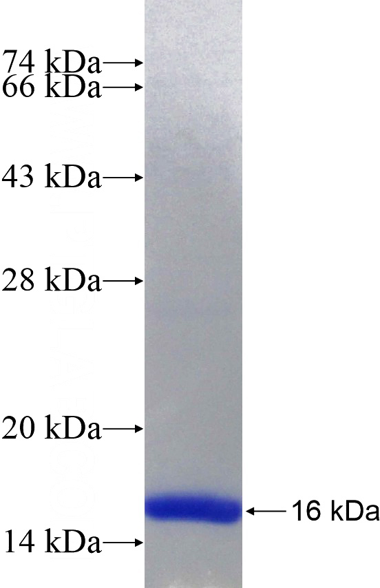 Recombinant Human VHL SDS-PAGE