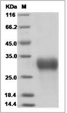 Rat IGFBP6 / IBP6 Protein (His Tag)