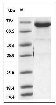 Sus scrofa (Pig) Transferrin / TF Protein (Fc Tag) SDS-PAGE