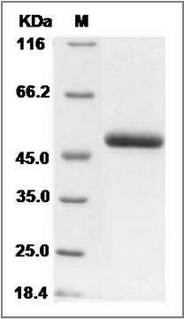 Mouse SerpinF1 / PEDF Protein (His Tag) SDS-PAGE