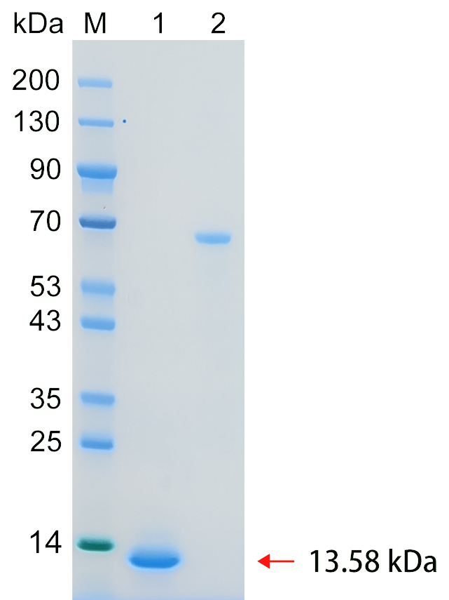 Recombinant MIEN1 protein (His tag) SDS-PAGE