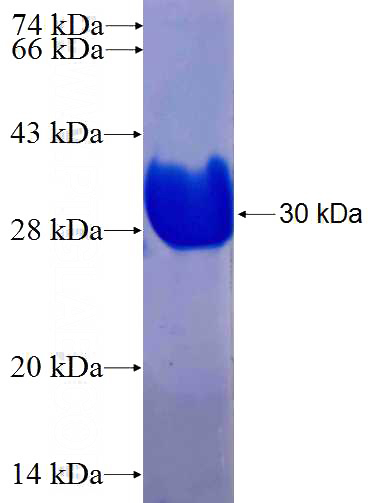 Recombinant Human MAST4 SDS-PAGE