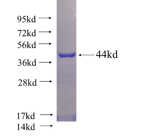 Recombinant human CCDC155 SDS-PAGE