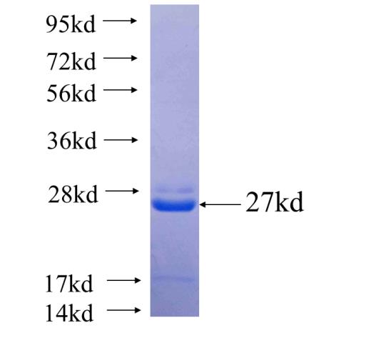 Recombinant human SDF2L1 SDS-PAGE