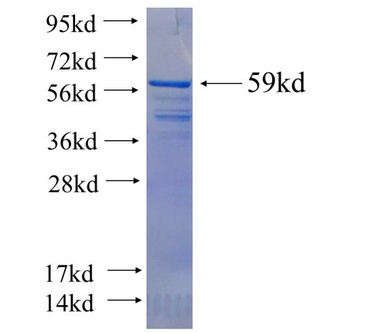 Recombinant human NFATC2 SDS-PAGE