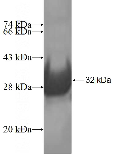 Recombinant Human DDAH2 SDS-PAGE