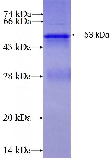 Recombinant Human GGA2 SDS-PAGE