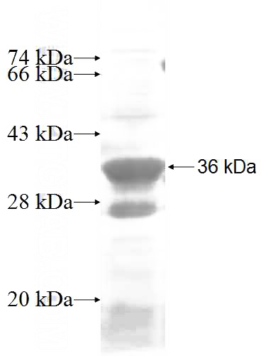 Recombinant Human ABI2 SDS-PAGE