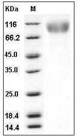 Human CEACAM5 / CD66e Protein (His Tag) SDS-PAGE