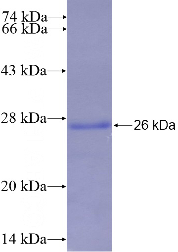 Recombinant Human MED30 SDS-PAGE