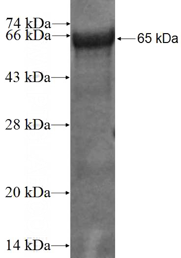 Recombinant Human CDC123 SDS-PAGE