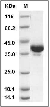 Cynomolgus NAP-2 / PPBP / CXCL7 Protein (Fc Tag) SDS-PAGE