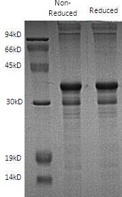 Human ESR2/ESTRB/NR3A2 (His tag) recombinant protein