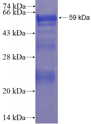 Recombinant Human DAZL SDS-PAGE
