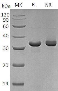 Human ARG2 (His tag) recombinant protein